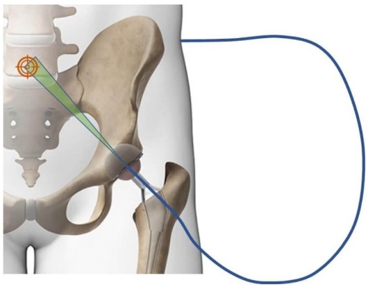 Medical Device Market Analysis
